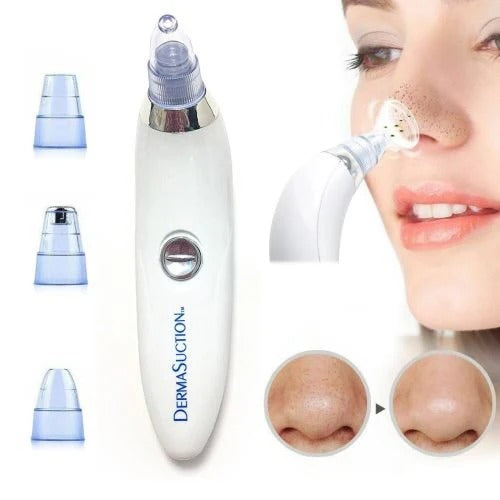 Derma Suction – Vakuum aparat za uklanjanje akni i mitisera