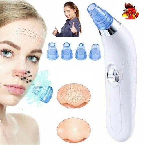 Derma Suction – Vakuum aparat za uklanjanje akni i mitisera